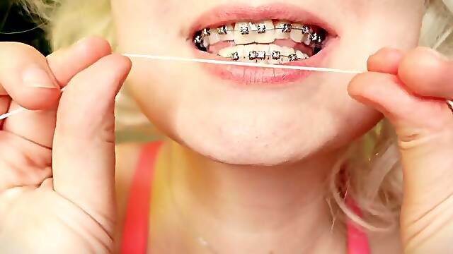 My 2nd day in braces: cleaning by dental floss
