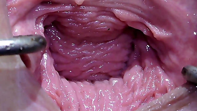 Wide Open