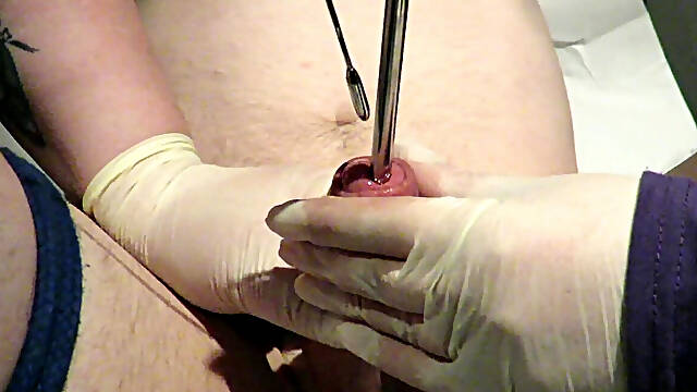 Massive Treatment